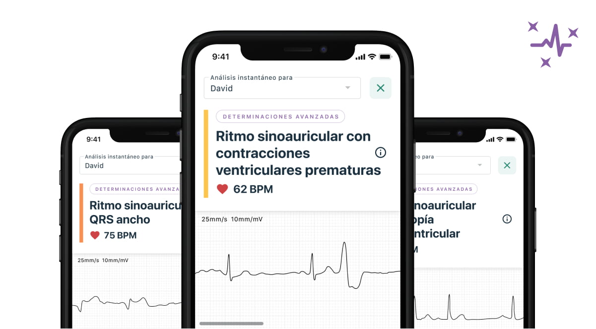 image of mobile devices showing the new Advanced Determinations feature as part of KardiaCare