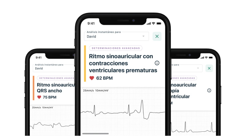 image of mobile devices showing the new Advanced Determinations feature as part of KardiaCare